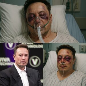 SAD NEWS: Elon Musk Brutally Attacked Just 15 Minutes Ago — Doctors Monitor Billionaire Entrepreneur Is Now in Critical Condition After New Announcement...-na