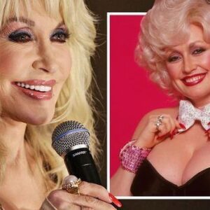 SHOCKING BEAUTY SECRETS: Did Dolly Parton Go Too Far With Plastic Surgery? Fans Are Divided Over Stunning Before-and-After Images