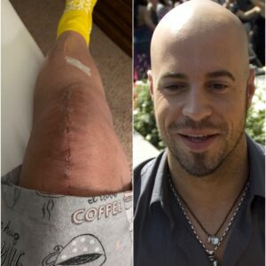 GOOD NEWS from Chris Daughtry: A heartfelt message after surgery_TD