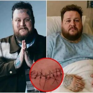 GOOD NEWS from Jelly Roll: A heartfelt message after surgery "I still have a long way to go