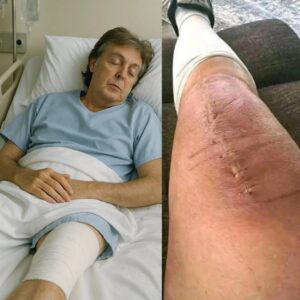 Paul McCartney Shares Emotional Message After Surgery: “I’m Fighting. But I Can’t Do It Alone.” - nh