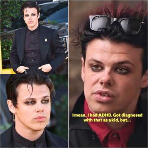 My Pain Is My Power”: Yungblud Opens Up About ADHD, Loneliness, and the Healing Power of His Fans