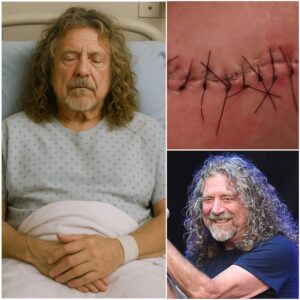 GOOD NEWS from Robert Plant: A Heartfelt Message After Surgery nango