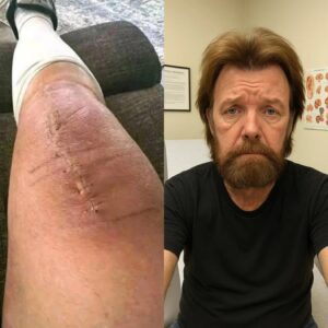 GOOD NEWS from Ronnie Dunn: The Country Legend Speaks Out After Surgery
