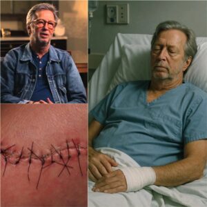 GOOD NEWS from Eric Clapton: A Heartfelt Message After Surgery