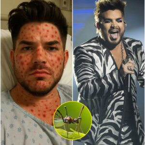 HEARTBREAKING NEWS: Global Music Icon Adam Lambert Rushed to Hospital With ‘Severe’ Illness — Doctors Admit They’ve Never Seen a Case Like This Before… nh