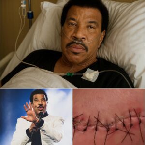 Lionel Richie Shares Heartfelt Update After Surgery, Inspires Fans With His Road to Recovery nh