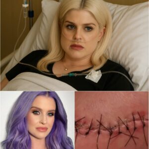 Kelly Osbourne Shares Heartfelt Update After Surgery, Inspires Fans With Her Road to Recovery nh