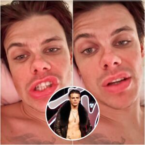 YUNGBLUD Forced to Cancel His Philadelphia Tour Stop After Falling Ill, Shares Heartfelt Apology and Disappointment with Fans