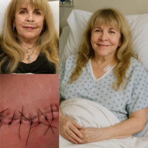 GOOD NEWS: Stevie Nicks Breaks Her Silence with a Heartfelt Post-Surgery Message_cn