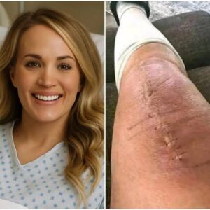 ๐ BREAKING: Carrie Underwood Shares Inspiring Health Update ๐