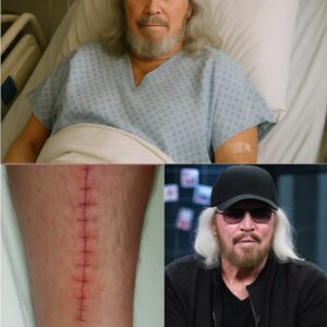 GOOD NEWS from Barry Gibb 🌟 The music legend shares a heartfelt update after surgery, thanking fans for their love, prayers, and support.