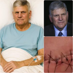 GOOD NEWS from Franklin Graham: A Heartfelt Message After Surgery