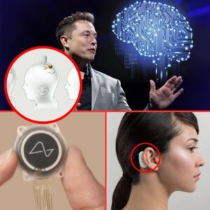 ELON MUSK GEARS UP FOR A NEURALINK “COMEBACK”: A brain technology 10 TIMES FASTER than human reflexes – a new era or an inhum@ne experiment?