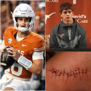 SAD NEWS: ARCH MANNING UNDERGOES LEG SURGERY AFTER OKLAHOMA GAME COLLISION 💔 - SUN
