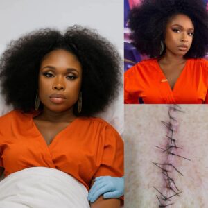 GOOD NEWS from Jennifer Hudson: A Heartfelt Message After Surgery nn