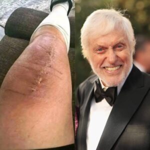 💚 GOOD NEWS from Dick Van Dyke: A Heartfelt Message After Surgery — “I Believe in Healing.” 🌟