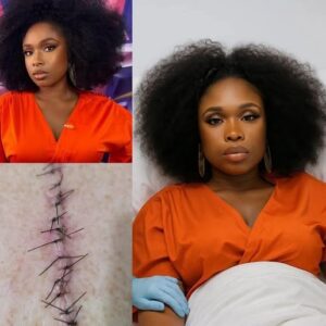💖 GOOD NEWS: Jennifer Hudson Speaks After Surgery 💖🔥TT