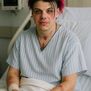 “I Shouldn’t Have Survived This”: YUNGBLUD Breaks Silence After Tragic Accident