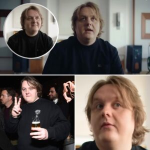 Lewis Capaldi Exposes “Fake Friends” in Hollywood — Says Stars Lied About Supporting Him During His Tourette’s Battle! ws