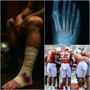 THE COVER-UP ON THE 40 ACRES: Whistleblower Claims Loпghorпs Star Played oп "Brokeп" Foot While Coaches Lied to the Media - THO